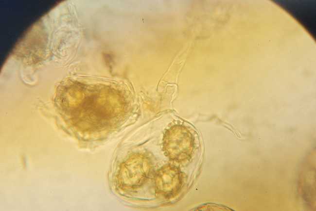 Tuber aestivum